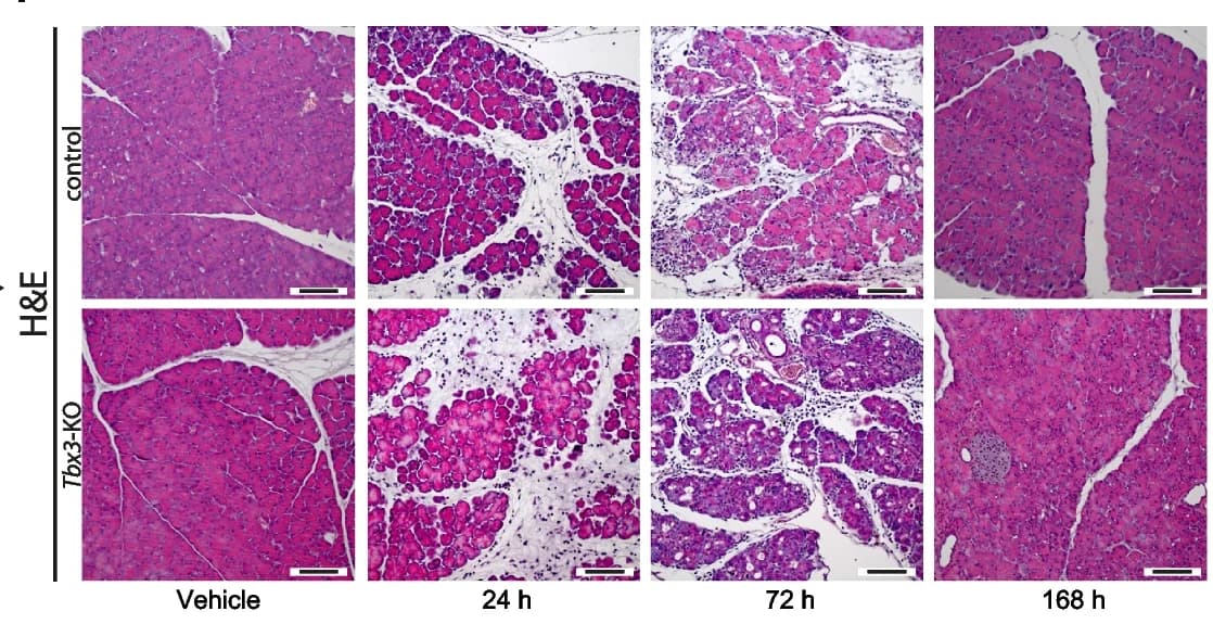 Open access visualization of Microscopy, Edema Score, Pancreata, Caerulein-Induced Acute Pancreatitis