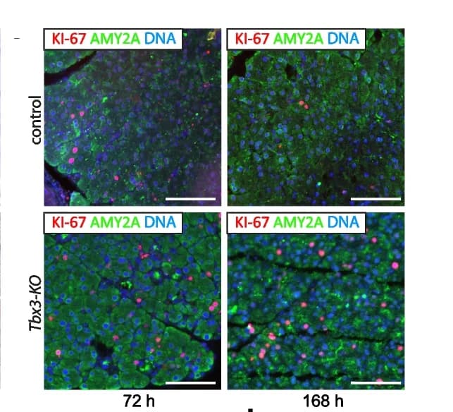 Open access visualization of Microscopy, Immunohistochemistry Staining, KI-67, Immunofluorescence Co-Staining, KI-67/AMY2A