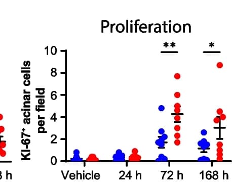 Open access visualization of Scatter Plot, Error Bars, Quantification, KI-67-Positive Acinar Cells, Pancreata