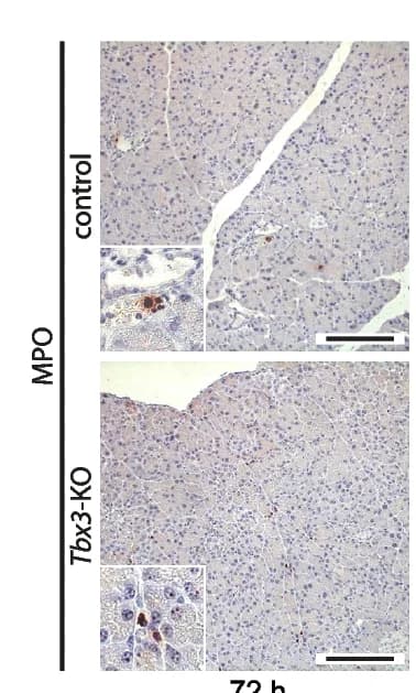 Open access visualization of Microscopy, Photo, Immunohistochemistry, MPO+ Neutrophils, Acute Pancreatitis