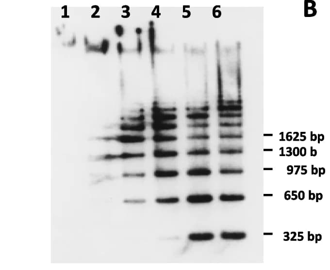 Open access visualization of Gel, Southern Blot, Genomic DNA, Channel Catfish, Restriction Endonuclease