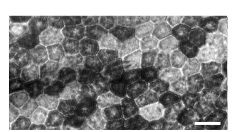 Open access visualization of Microscopy, hESC-RPE Monolayer, Patch Pipette, Bright-Field Microscopy