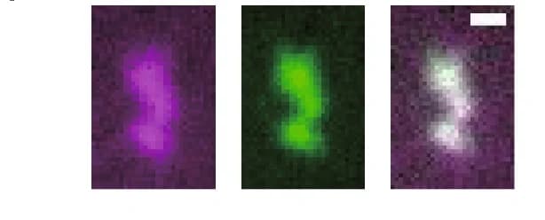 Open access visualization of Microscopy, Linear Fractal-shaped Aggregates, mCherry, ThT, Fluorescence Images