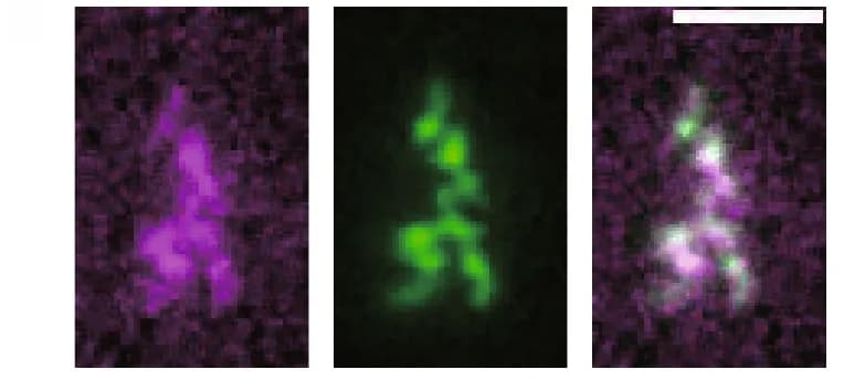 Open access visualization of Microscopy, Branched Fractal-shaped Aggregates, mCherry, ThT, Fluorescence Images