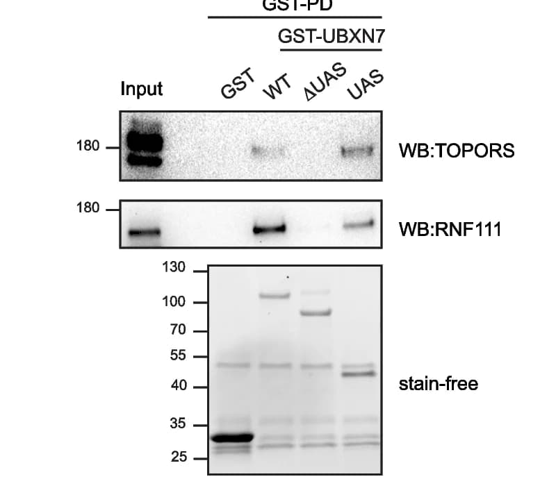 Open access visualization of Gel, TOPORS, UBXN7-UAS, HEK-293 Cellular Extracts, GST-UBXN7 Constructs