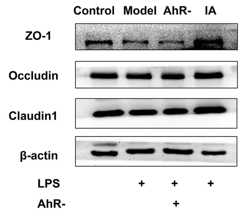 Open access visualization of Gel, Western blot, Densitometric analyses, Claudin-1, Occludin