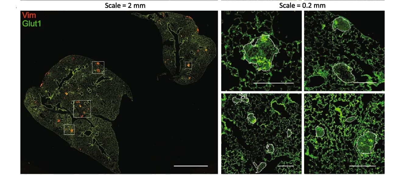 Open access visualization of Microscopy, Immunofluorescence, Mouse Lungs, 143B, Lung-Colonizing Tumors