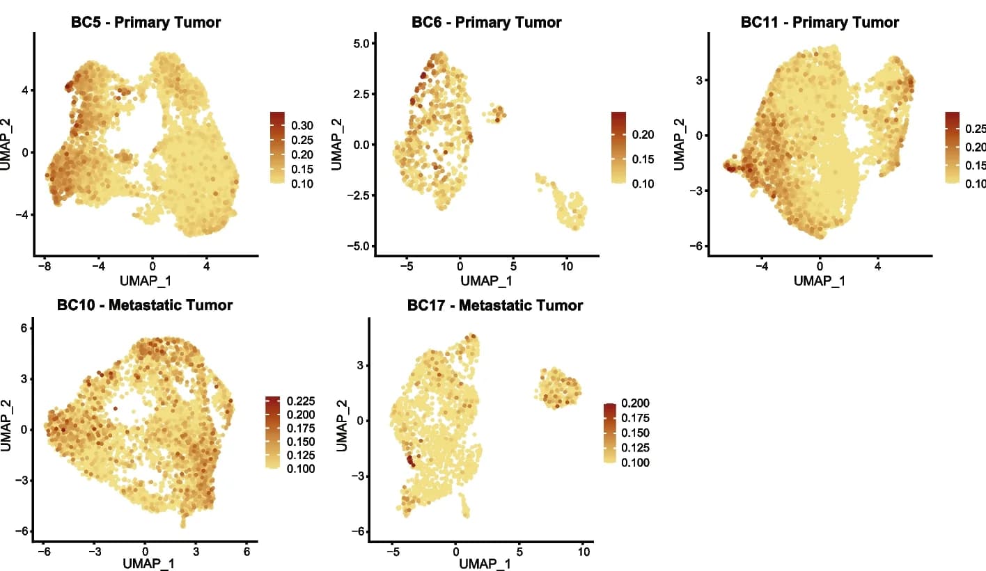 Open access visualization of UMAP, FeaturePlots, Glycolysis Module Score, Patient Primary Tumor, Metastatic Tumor