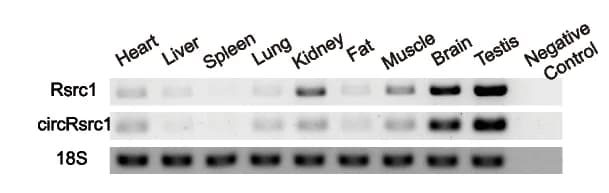 Open access visualization of Gel, Rsrc1, circRsrc1, RT-PCR, Mouse Tissues