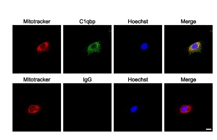 Open access visualization of Microscopy, Confocal Microscopy, GC-1 spg Cells, C1qbp, Mitotracker