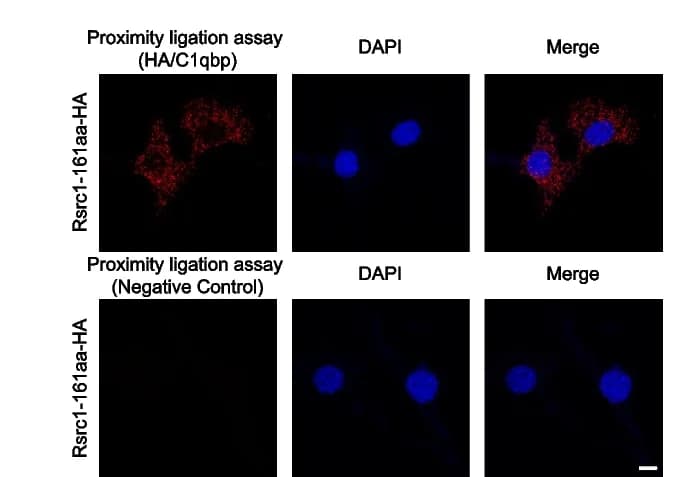 Open access visualization of Microscopy, Immunofluorescence, GC-1 spg Cells, Rsrc1-161aa-HA, PLA Signal