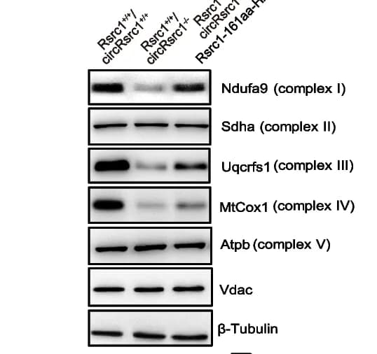 Open access visualization of Gel, Western blotting, Mitochondrial respiratory proteins, Wild-type cells, Rsrc1 + / + /circRsrc1 -/- cells
