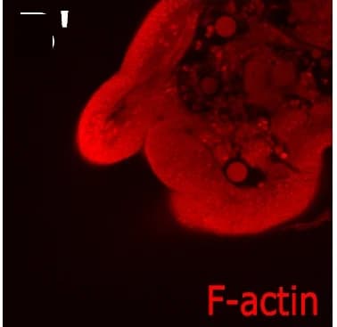 Open access visualization of Microscopy, Abdominal legs, DNA, F-actin, Aristaless1