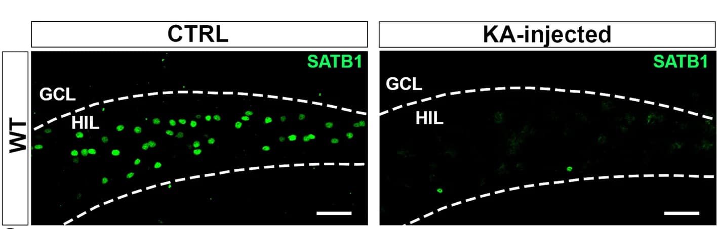 Open access visualization of Microscopy, Confocal Images, SATB1, Neurons, WT