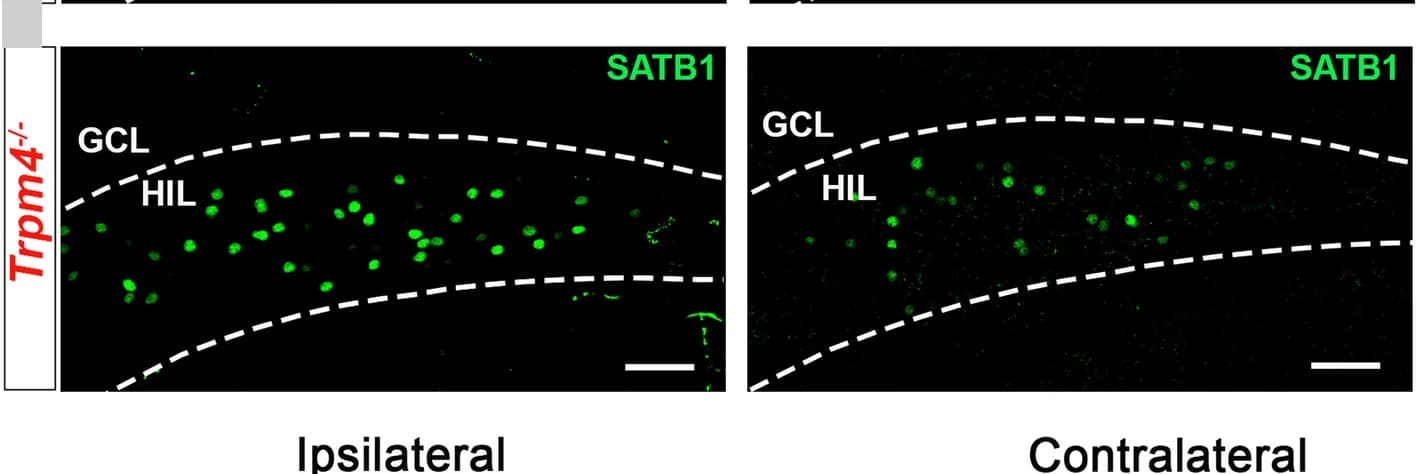 Open access visualization of Microscopy, Confocal Images, SATB1, Neurons, Trpm4