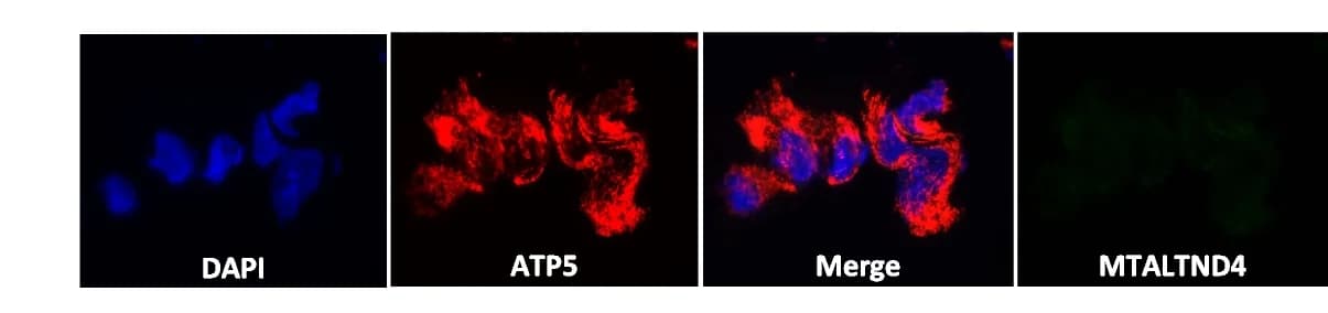 Open access visualization of Microscopy, MTALTND4, ATP5, Immunofluorescence, HeLa cells