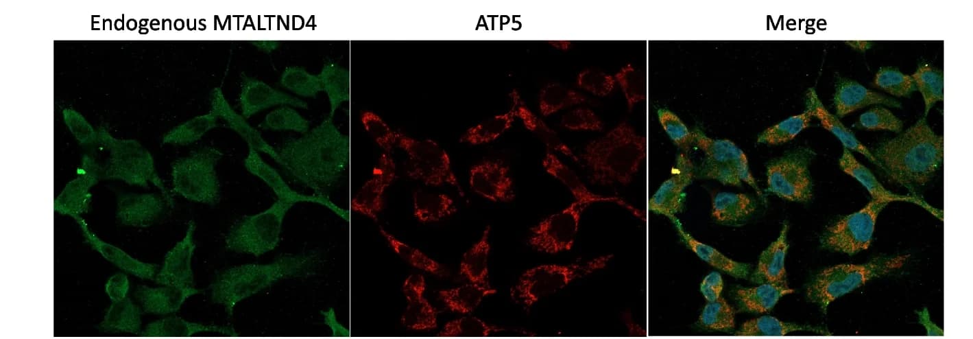 Open access visualization of Microscopy, MTALTND4, ATP5, Immunofluorescence, HeLa cells