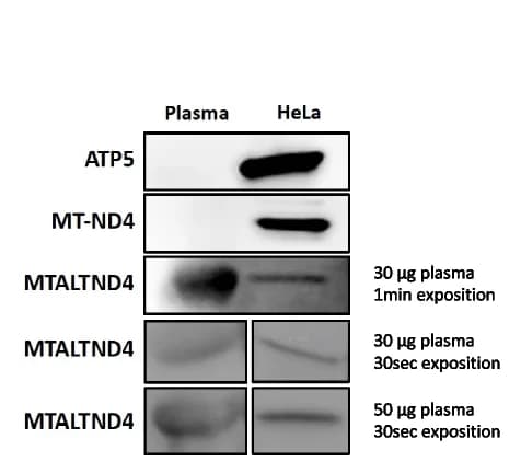 Open access visualization of Gel, MTALTND4, ATP5, Western blotting, Human plasma