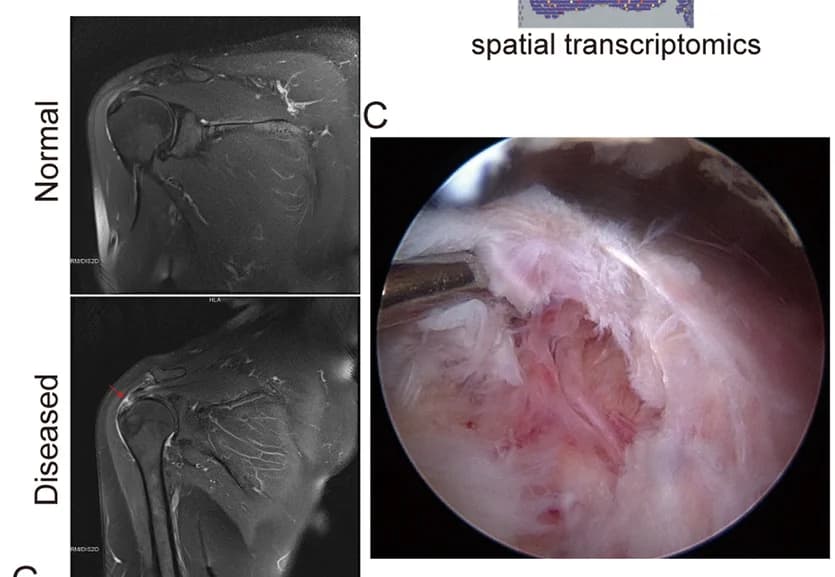 Open access visualization of Microscopy, Photo, MRI, Normal Tendon, Lesioned Tendon