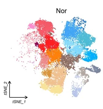 Open access visualization of Scatter Plot, UMAP, t-SNE, Donor Origins, Normal Samples