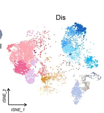 Open access visualization of Scatter Plot, UMAP, t-SNE, Donor Origins, Normal Samples