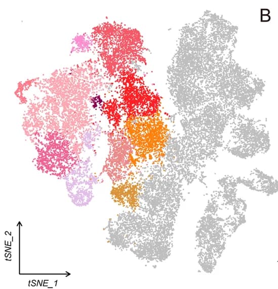 Open access visualization of Scatter Plot, UMAP, PCA, t-SNE visualization, Tenocytes