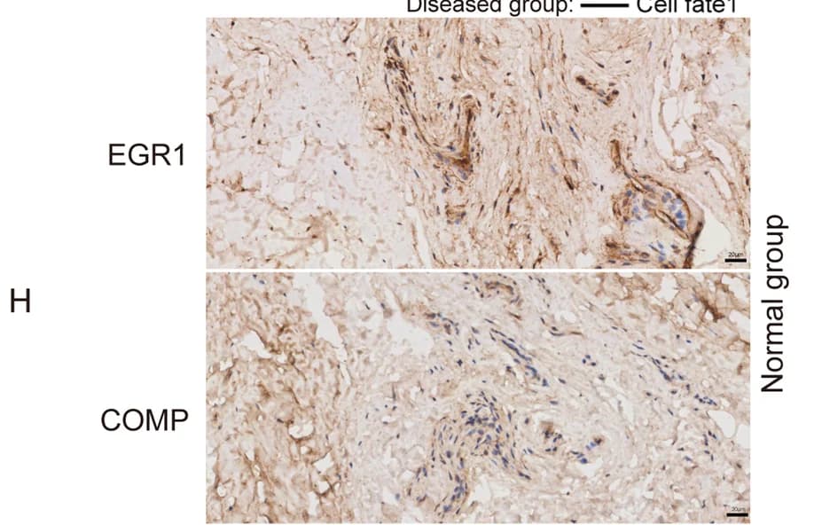 Open access visualization of Microscopy, Immunohistochemistry, EGR1, COMP, Normal Tendon