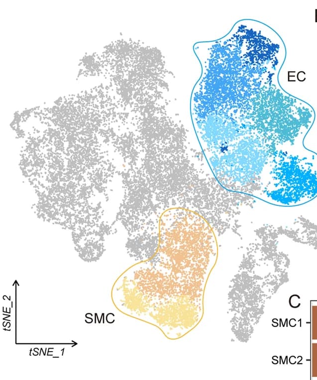 Open access visualization of Scatter Plot, UMAP, Bar Plot, t-SNE, Endothelial Cells
