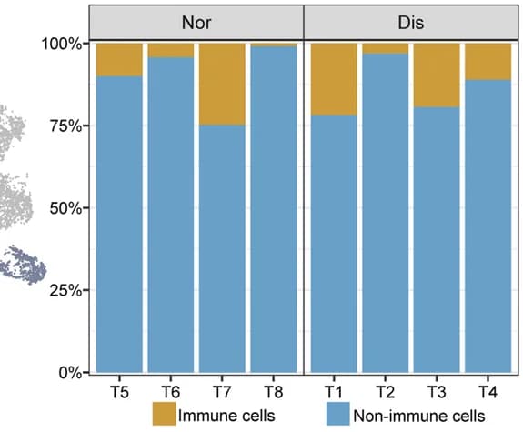 Open access visualization of Stacked Bar Plot, Bar Plots, Immune Cells, Normal Group, Diseased Group