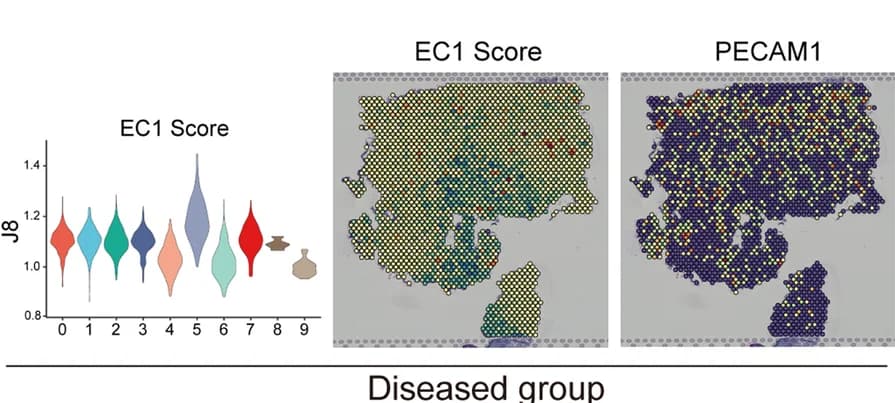 Open access visualization of Violin Plot, Scatter Plot, Heatmap, EC1 Score, Diseased Group