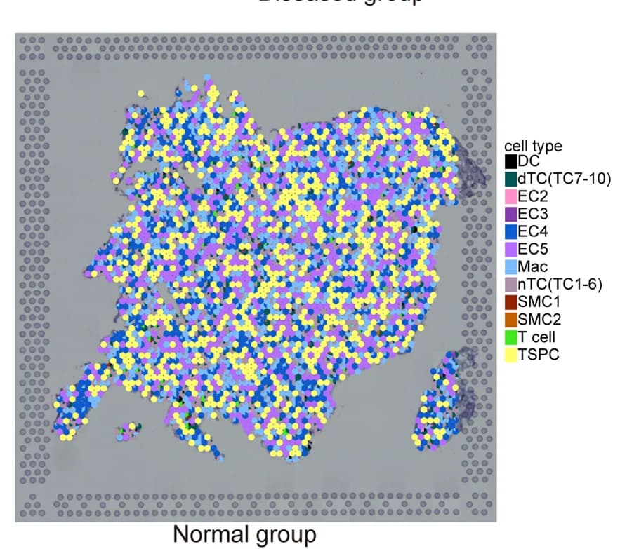 Open access visualization of Scatter Plot, Spotlight Plots, Spatial Distribution, Cell Populations, Normal Tendons