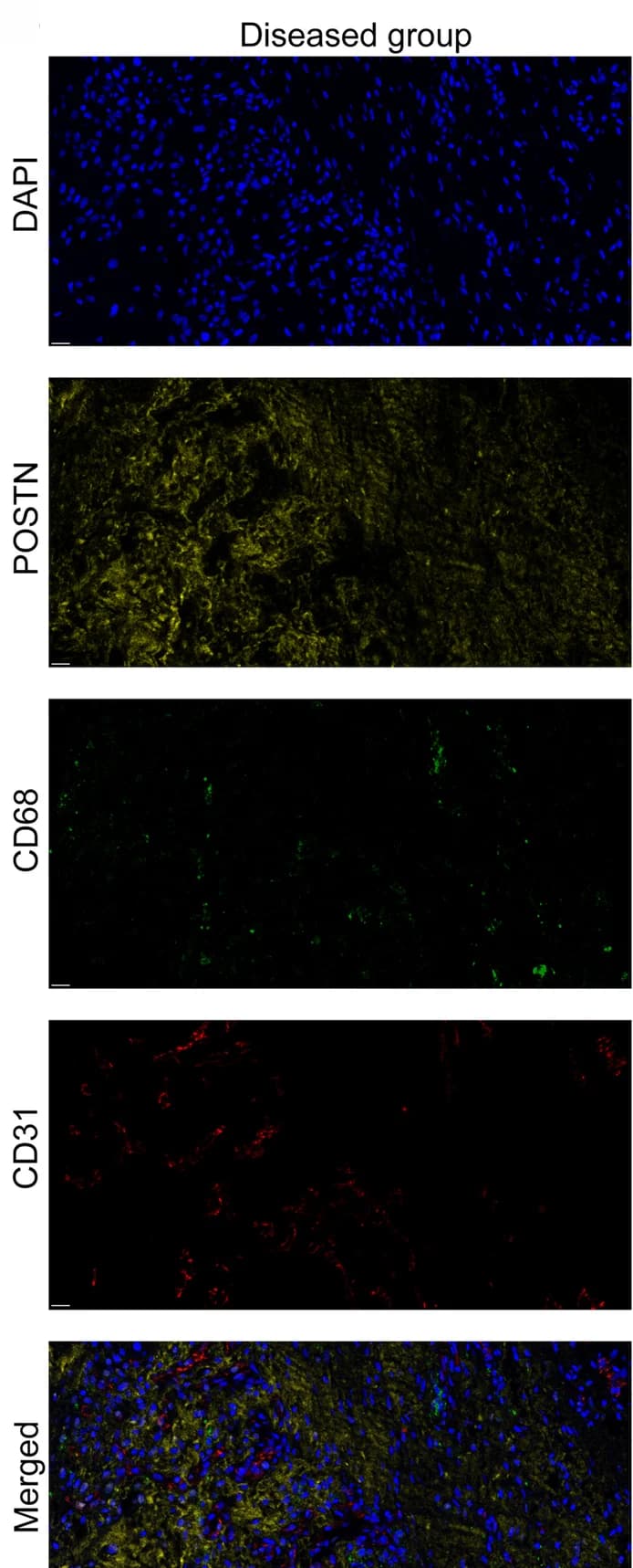 Open access visualization of Microscopy, Immunofluorescent Staining, POSTN, CD68, CD31