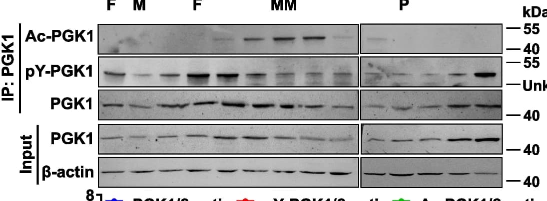 Open access visualization of Gel, PGK1, PGK1 Phosphorylation, PGK1 Acetylation, Fat Body