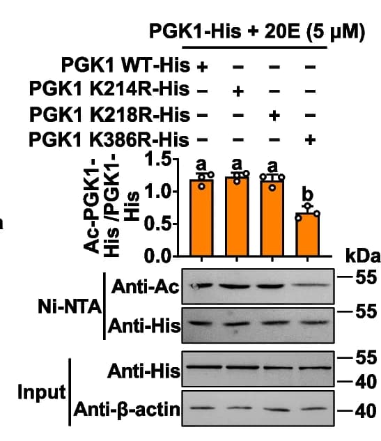 Open access visualization of Bar Plot, Photo, Gel, PGK1 WT-His, PGK1 Mutants