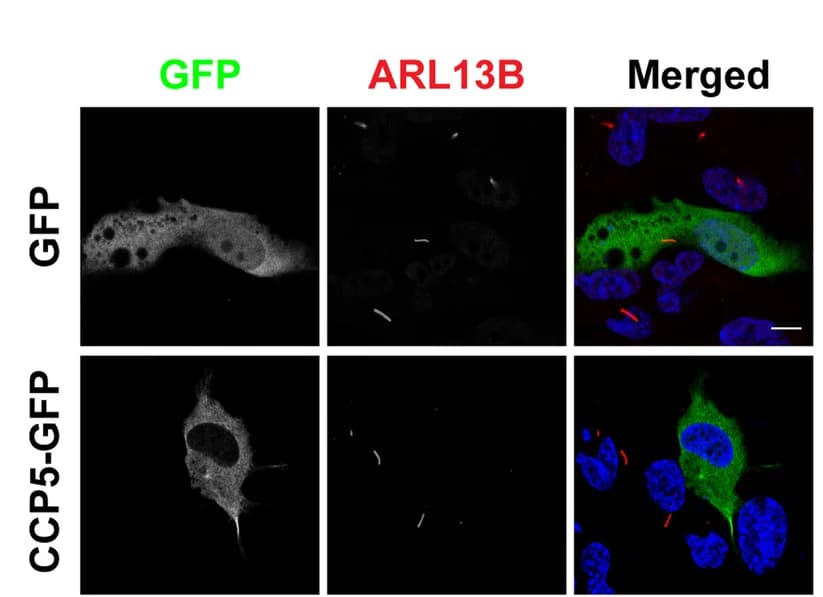 Open access visualization of Microscopy, Serum Starvation, hTERT-RPE1 Cells, GFP, CCP5-GFP