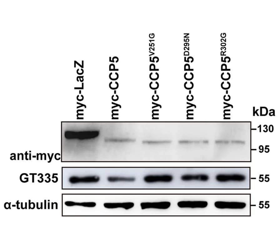 Open access visualization of Gel, Porcine Tubulin, HEK293T Cells, Myc-tagged LacZ, CCP5