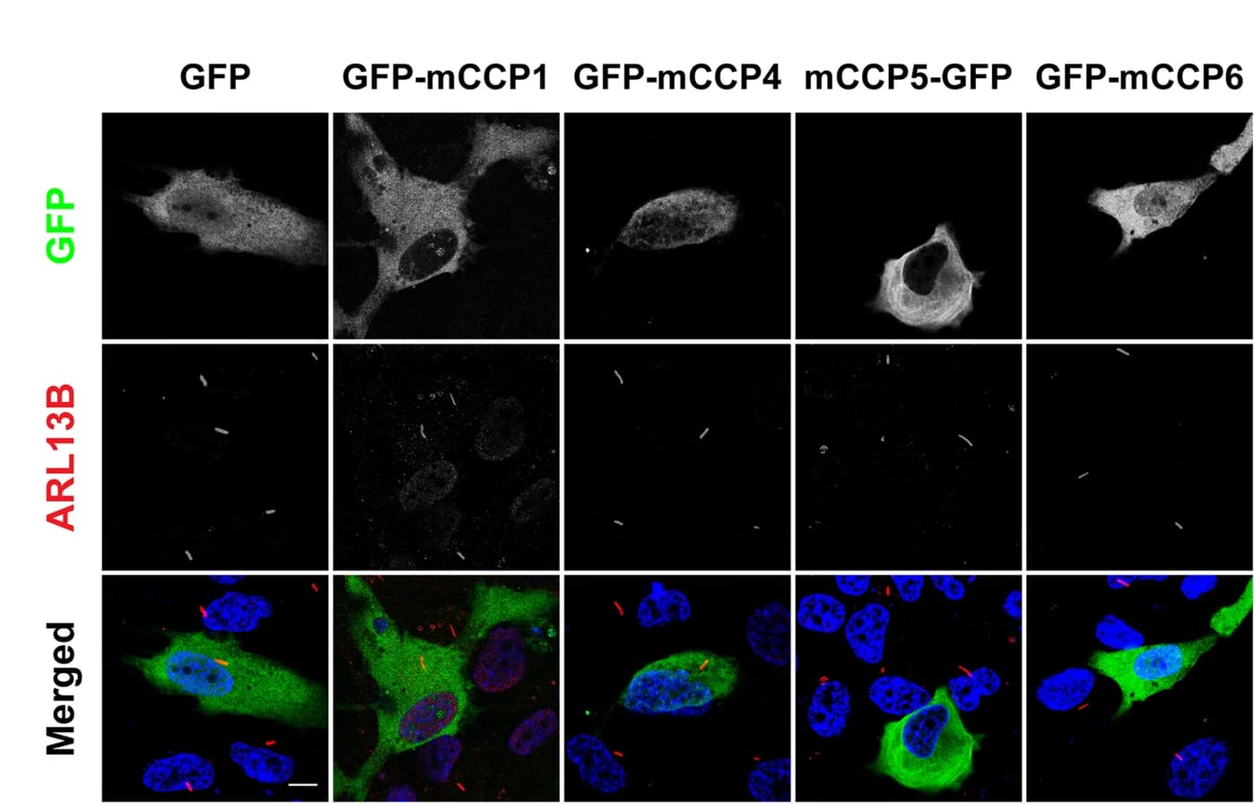 Open access visualization of Microscopy, hTERT-RPE1 Cells, Transfection, Serum Starvation, Immunostaining