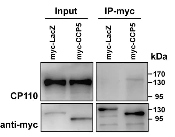 Open access visualization of Gel, HEK293T Cells, Cell Lysates, Immunoprecipitation, CP110