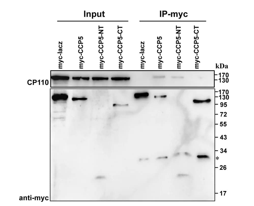 Open access visualization of Gel, HEK293T Cells, Immunoprecipitation, CP110, CCP5