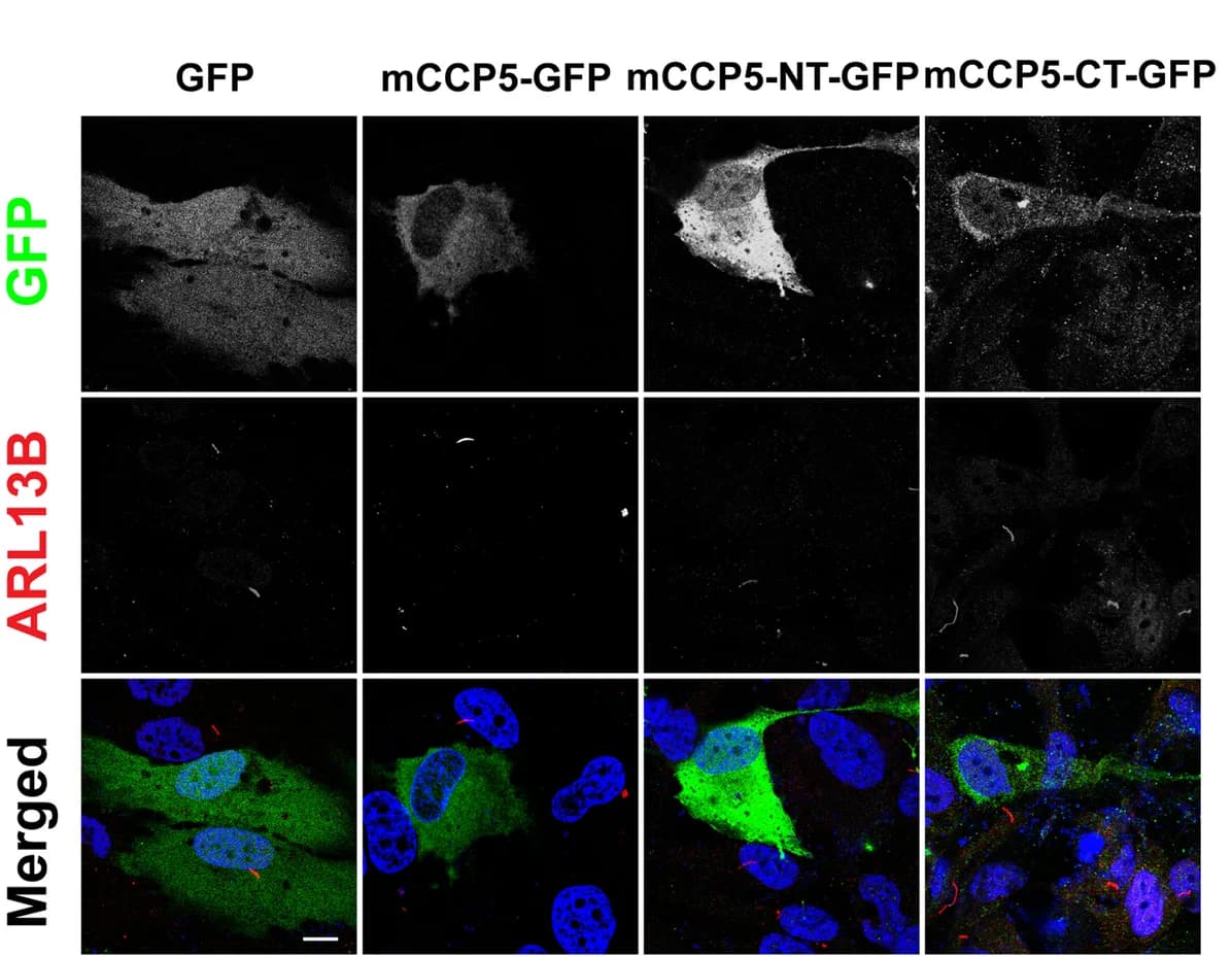 Open access visualization of Microscopy, hTERT-RPE1 Cells, GFP, CCP5-GFP, CCP5 Truncations