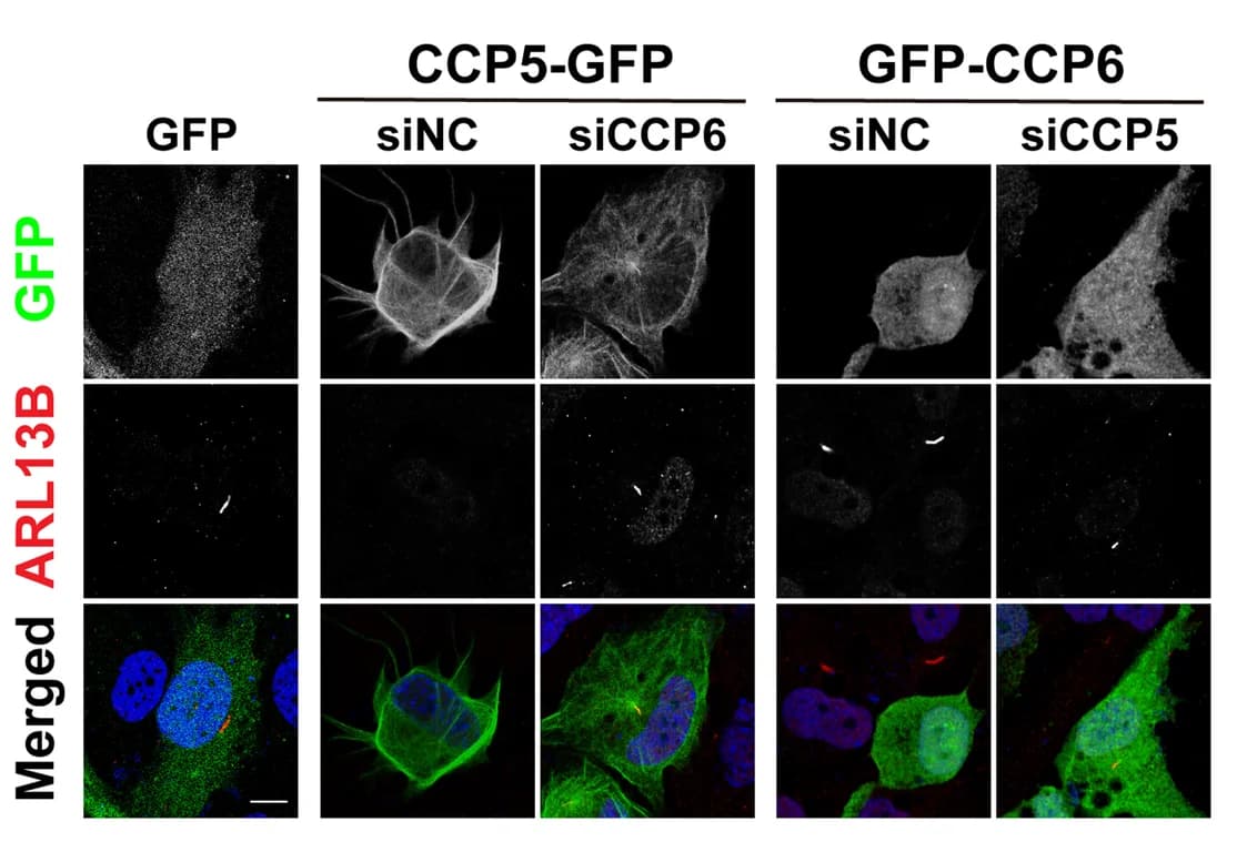 Open access visualization of Microscopy, hTERT-RPE1 Cells, GFP, siRNA, ARL13B