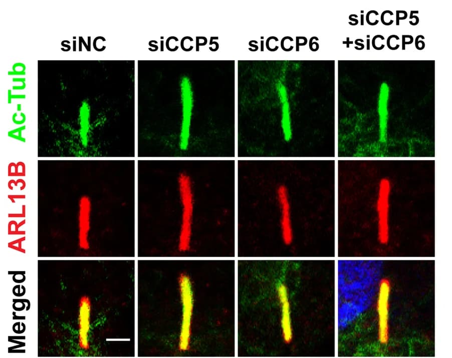 Open access visualization of Microscopy, hTERT-RPE1 Cells, siRNA, Acetylated-tubulin, ARL13B
