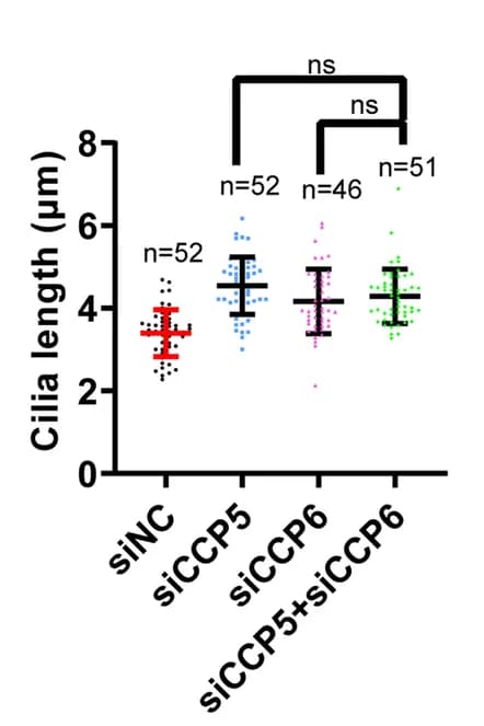 Open access visualization of Scatter Plot, Error Bars, Cilia Length, ARL13B, hTERT-RPE1 Cells