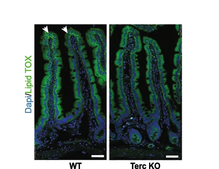 Open access visualization of Microscopy, LipidTOX Staining, Lipid Droplets, Intestinal Villi, Female Mice