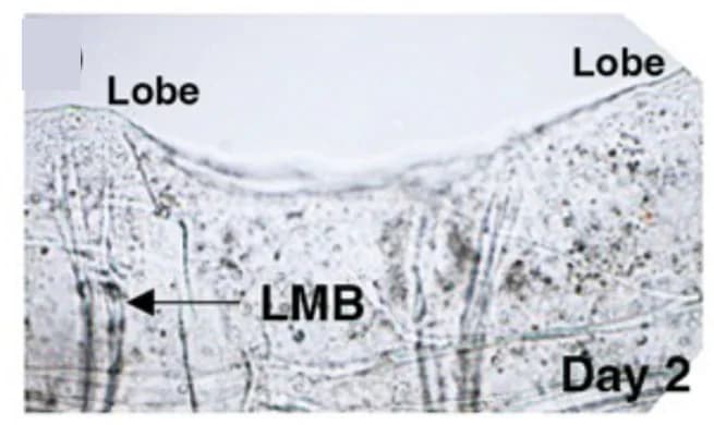 Open access visualization of Microscopy, Oral Siphon, Amputation