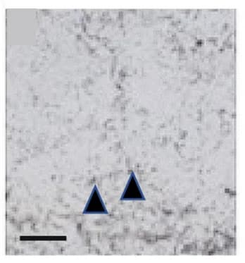 Open access visualization of Microscopy, In Situ Hybridization, hsp70, Branchial Sac Vasculature, hsp70 siRNA