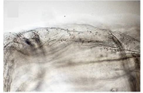 Open access visualization of Microscopy, Photo, Distal Edges, Oral Siphon, Oral Siphon Amputation