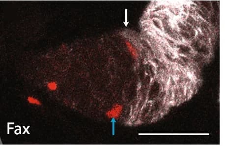Open access visualization of Microscopy, UAS-RFP, Fas3 antibody, ECs, RFP