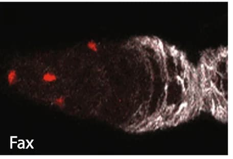 Open access visualization of Microscopy, UAS-RFP, Fas3 antibody, ECs, RFP
