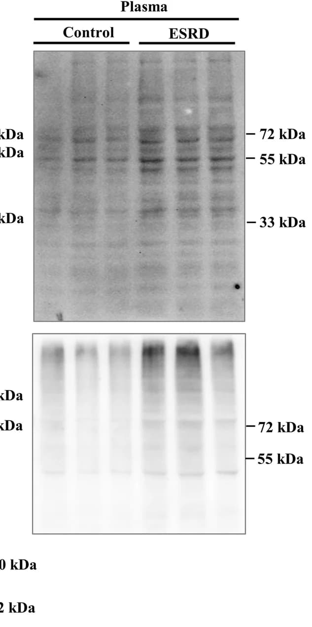 Open access visualization of Gel, Sulfotyrosine, Phosphotyrosine, Plasma, ESRD Patients